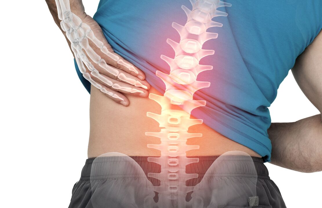 Le danger de l'ostecondrose lombaire