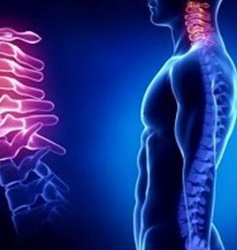 L'ostéochondrose cervicale peut être causée par des blessures au cou.