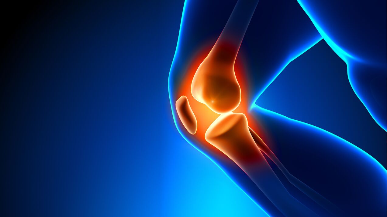 arthrose des articulations